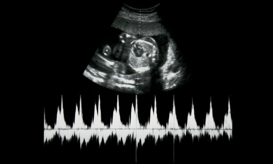 Image 5: Primera ecografía 5D o pack con las 2 primeras ecografías 