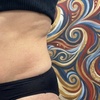 Image 1: Body Sculpting & Cellulite Reduction to Boost Contours & Confidence