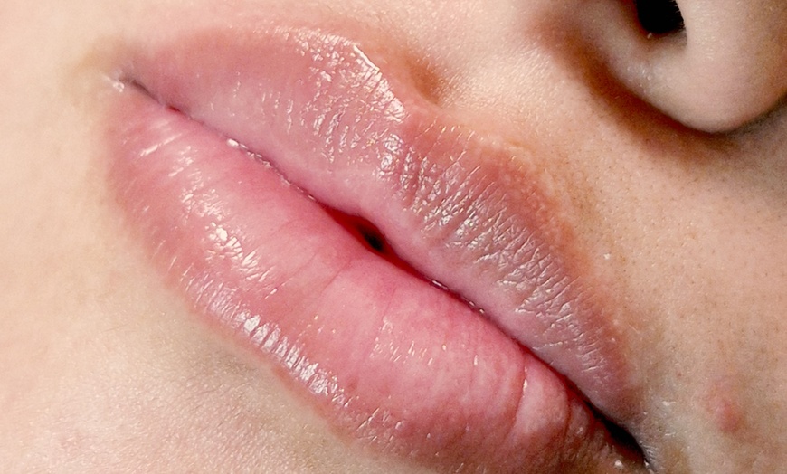 Image 4: Revitalize Your Lips with Hydra Gloss Lips or Glossyps