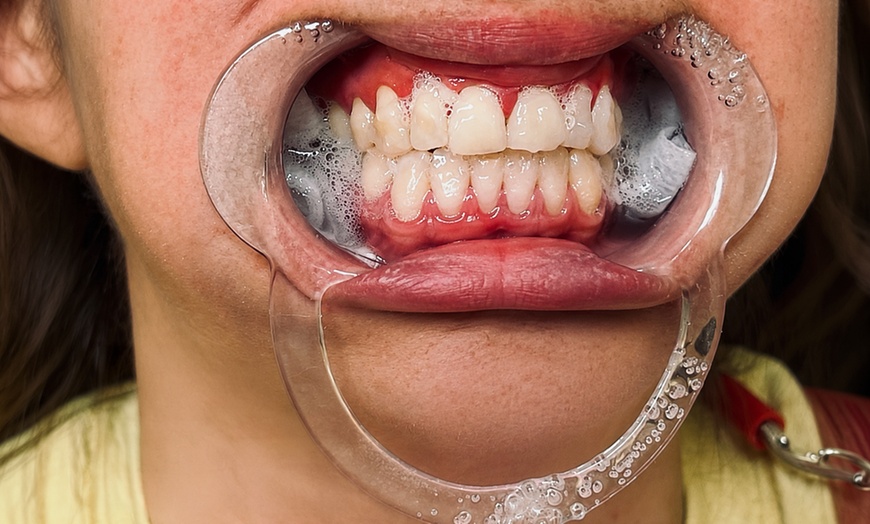 Image 4: Brighten Your Smile with Comprehensive Dental Care