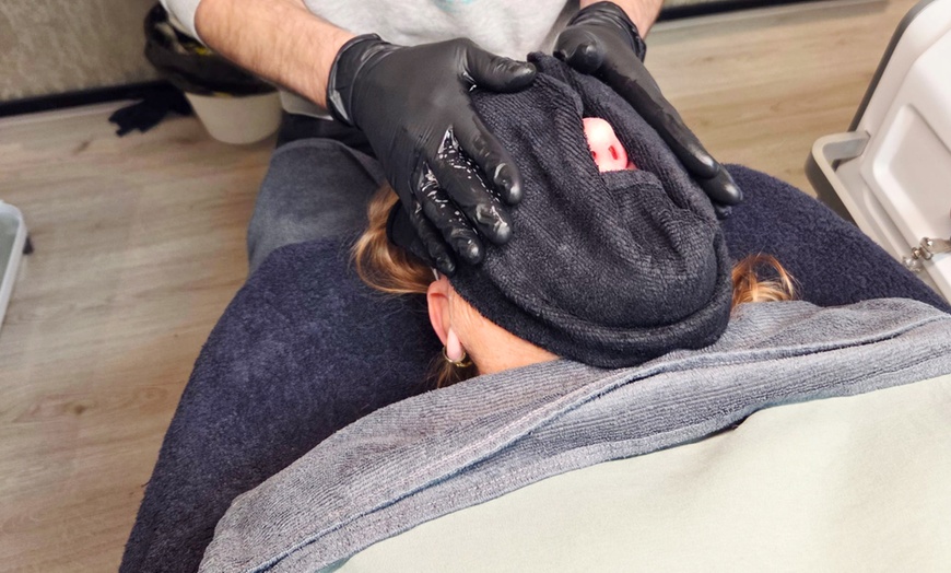 Image 3: Effectieve carbon laser peeling voor huidverjonging en collageenboost