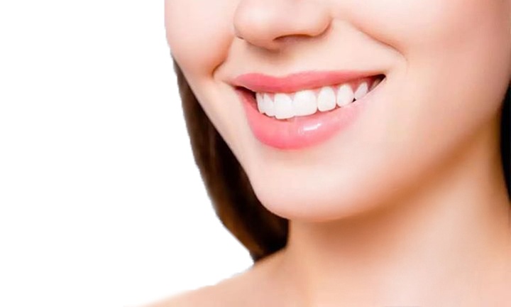Whiten w/t 60-Min Teeth Whitening: Beaming(16/20%)or DaVinci (17%)
