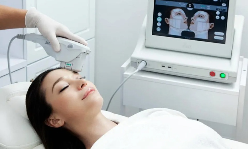 Image 1: Up to 48% Off on Ultherapy / Ultrasonic Facial at Benefit Aesthetics