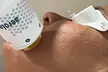 One, Three, or Five Laser Skin Resurfacing Treatments at Genesis Wellness Spa - Up to 87% Off - Second Medium