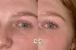 Lash Extensions 1:1- oder 2-3D Volumen-Technik mit UV Lampe, opt. inkl. Auffüllen für 1 Person (bis 59% sparen) - Second Medium