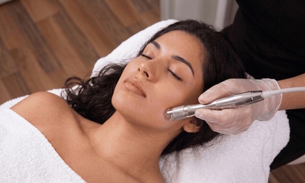 Diamond Microderabrasion facial with LED light therapy 1 hour - Beyond Esthetics Studio
