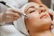 Glow with 30 Min Express Microdermabrasion, LED-45 Min, Lactic, Pigmentation or Salicylic A Peel (Up to 55%Off) - Image 3