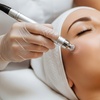 Image 3: 30 Min Express Microdermabrasion, LED-45 Min, Lactic Peel and More