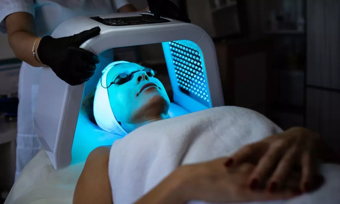 1 o 2 sesiones de lifting facial sin cirugía y opción a higiene facial