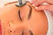 1, 2 o 3 sesiones de radiofrecuencia facial Indiba de 30 minutos para 1 persona, con hasta un 76% menos - Second Medium