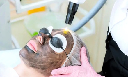 Carbon Laser Facial - Exotica Skin Care
