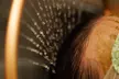 Nadine Rose Hair Studio Offers Single or Double Scalp Facial Intro or Deluxe Head Spa Treatment (Up to 43% Off) - Second Medium