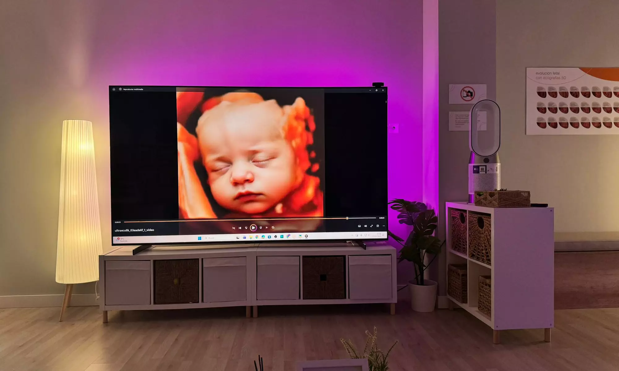 ¡Conoce a tu bebé! Ecografía emocional 5D o 8K con vídeo y canastilla