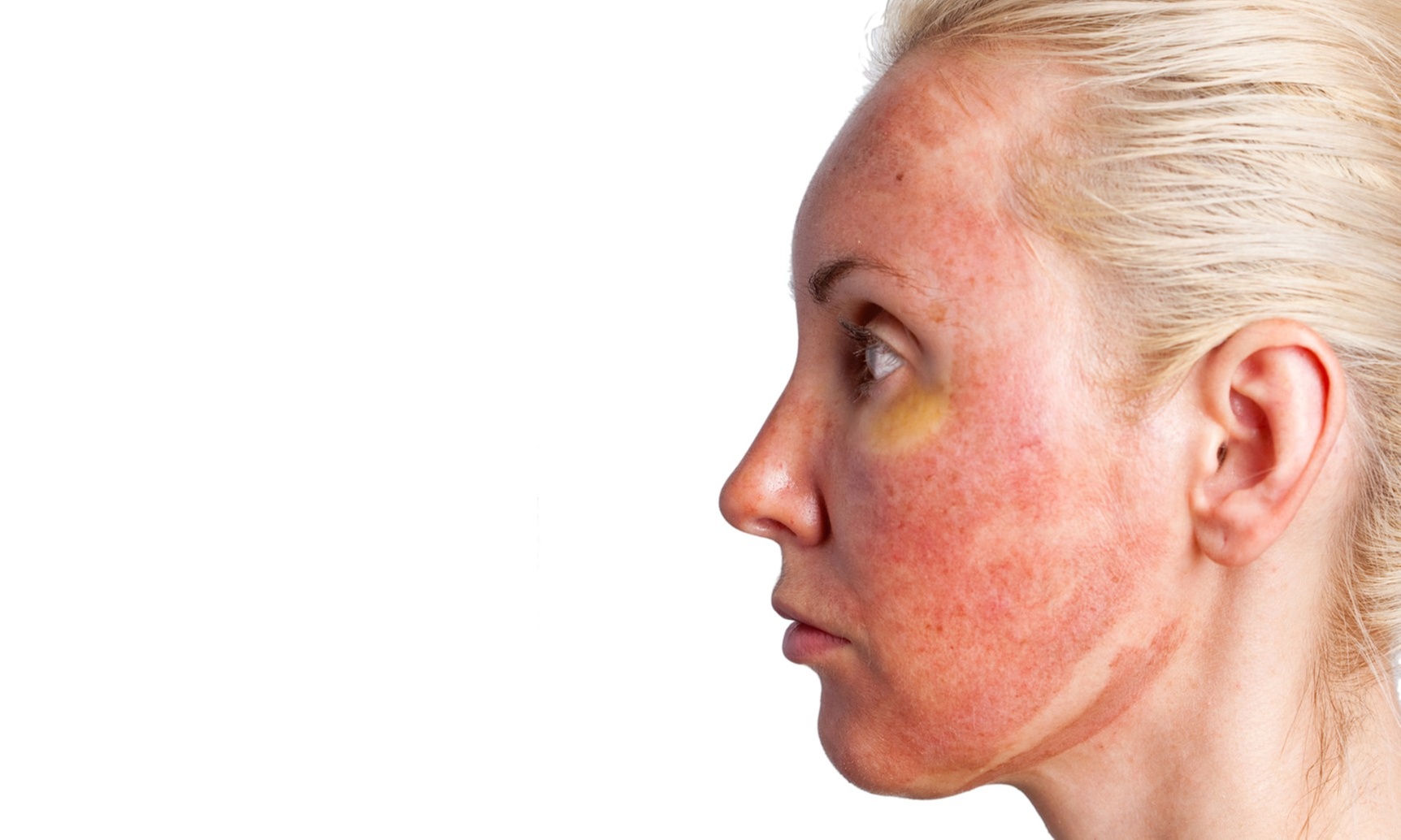 Up To 69% Off PRP at TrimBody MD San Marcos