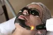 1 o 2 sesiones de Hollywood Peel facial con carbón activo y opción a fototerapia para 1 persona, al 55% - Image 5