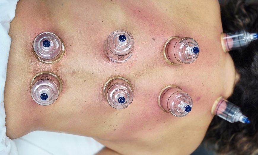 Image 3: Indulge in a 60-Minute Cupping or Manual Lymphatic Drainage Massage