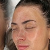 Image 2: Reveal Glowing Skin with One or Two Chemical Peels Session