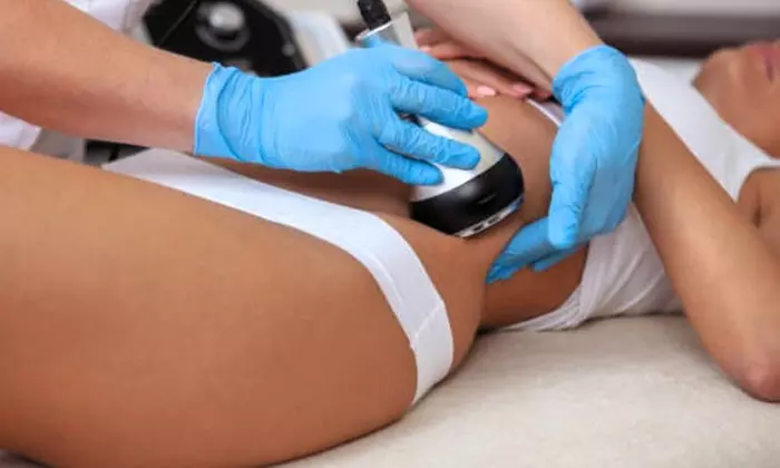 Hasta 9 sesiones de cavitación, vacumterapia o radiofrecuencia a elegir con presoterapia y masaje para 1 persona - Primary Image