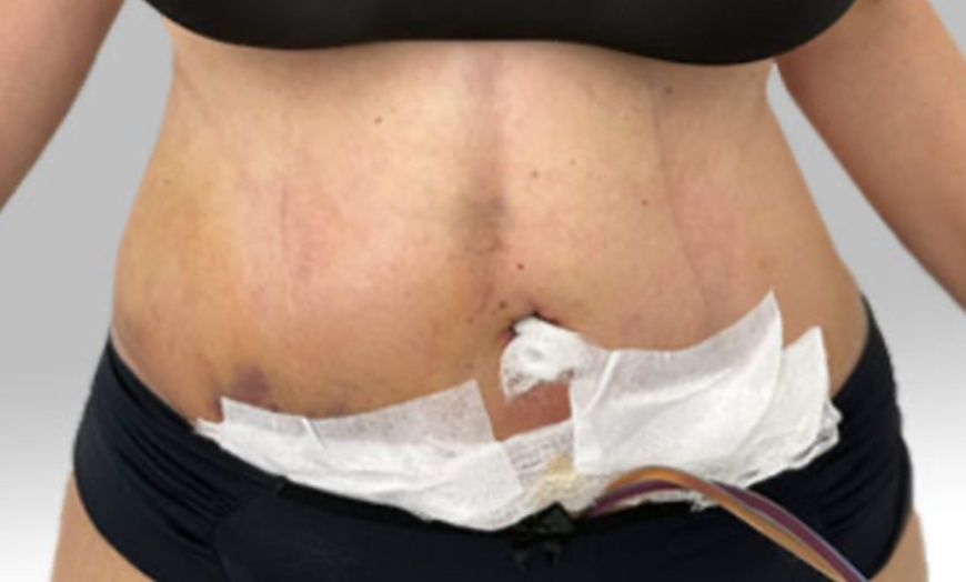 Image 1: Relax with 1, 3, or 5 Lymphatic Drainage Massages