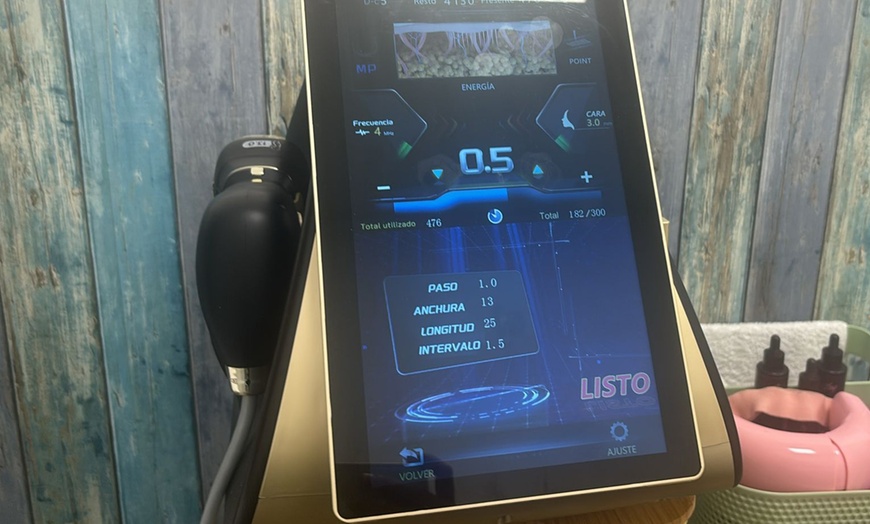 Image 3: Tratamiento HIFU 22D ultralifting en zona a elegir para 1 persona