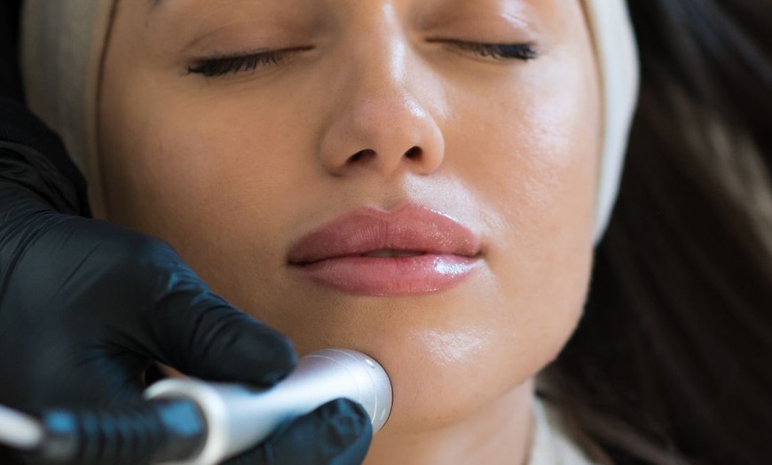Image 10: Hydrate and Glow Up with Hydrafacial and Skin Tightening