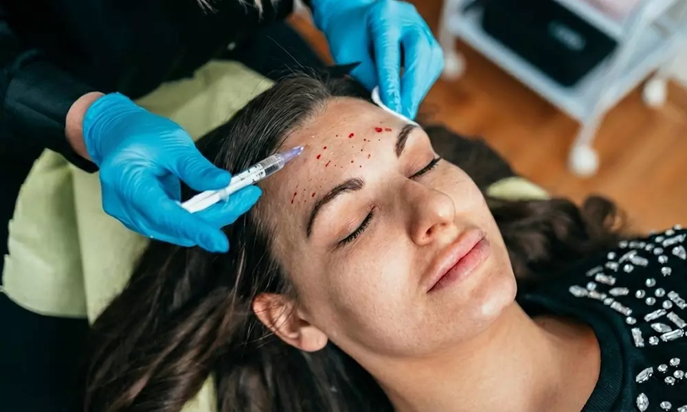 Get One, or Three PRP Facials, Vampire Face Tightening & Microneedling