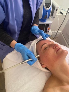 Diamond Microdermabrasion with Vitamin Infusion; Purchase Limits Apply - Fusion Of Beauty