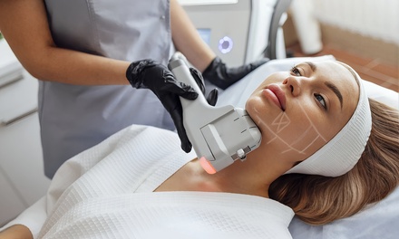 One IPL Photo Facial - Stephanies Cavi Lipo Spa