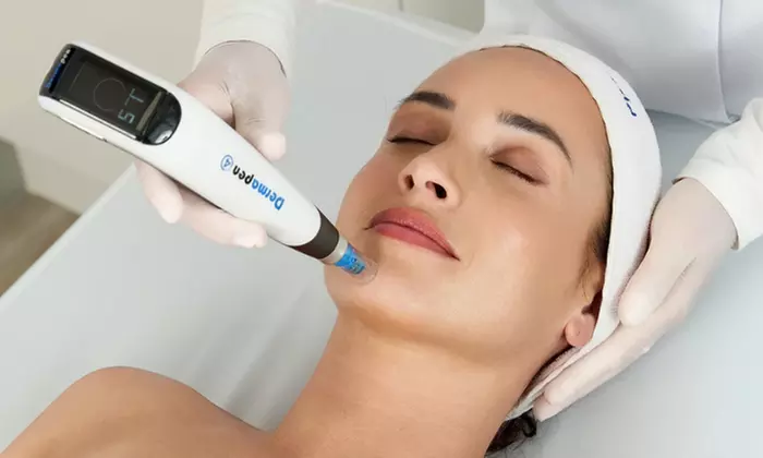 BB Glow Treatment with Microneedling + 15min LED Healing Therapy