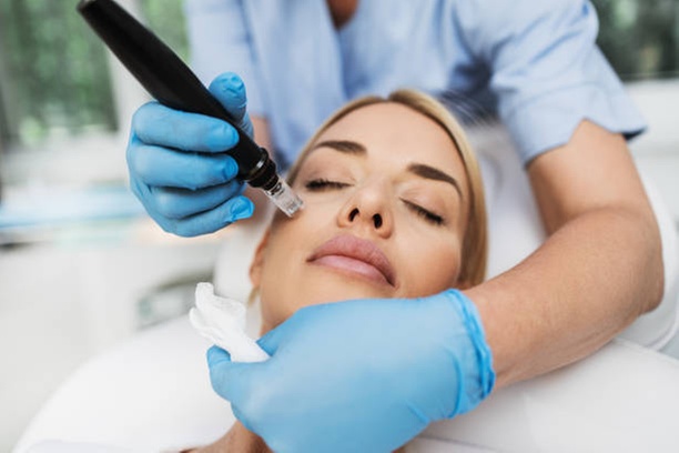 Transform Your Skin with One or Three Micro-Needling Treatments