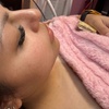 Image 4: Get 50, 100, or 150 Units of Dysport Treatments