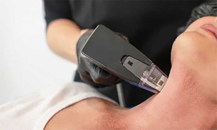 Experience Narotique Medspa's Morpheus8 Sessions on Face or Body, with up to 40% off, for radiant skin transformation.