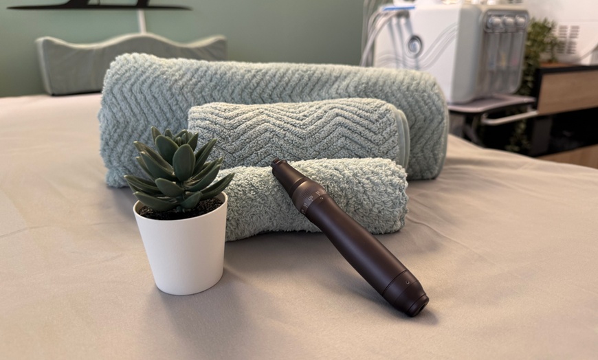 Image 4: Limpieza facial con opción a peeling químico, dermapen o hydrafacial