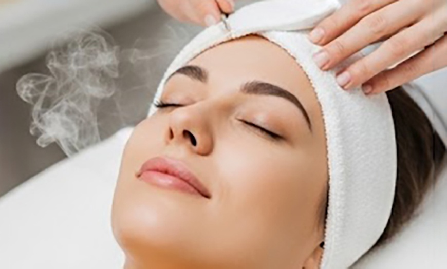 Image 1: Refresh Your Skin with Classic Microdermabrasion or Facial