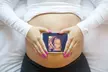 Up to 40% Off on Early Pregnancy, Reassurance, and Gender Ultrasounds at Universal Ultrasound Diagnostics - Second Medium