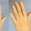 Image 2: Enhance Beauty with Deluxe Hand Rejuvenation! 