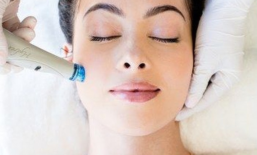 Image 1: One, Three, or Five Sessions of Signature Hydrafacial with Peel