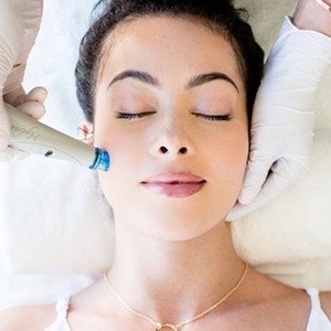 One Session of Signature Hydrafacial with Peel - Ivana Glow Medical Spa