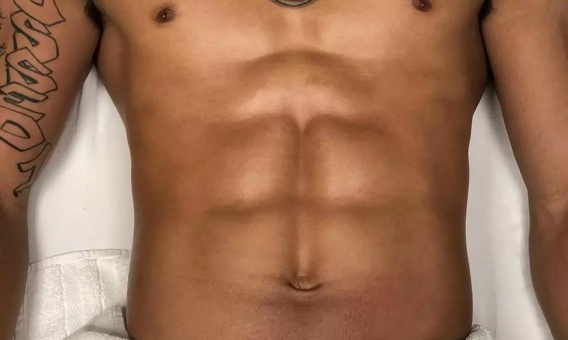 Men's & Women’s Brazilian Sugaring with Mask, Vajacial or Underarm