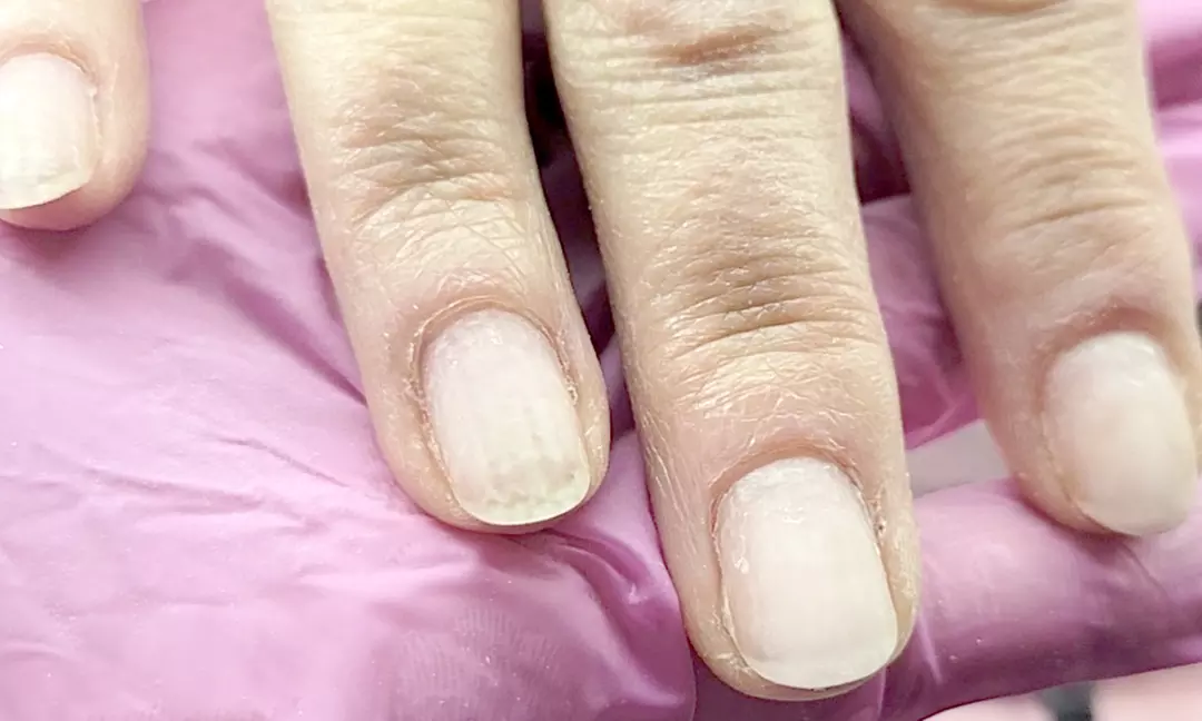 Transform Your Nails with Hard Gel Overlay on Natural Nails