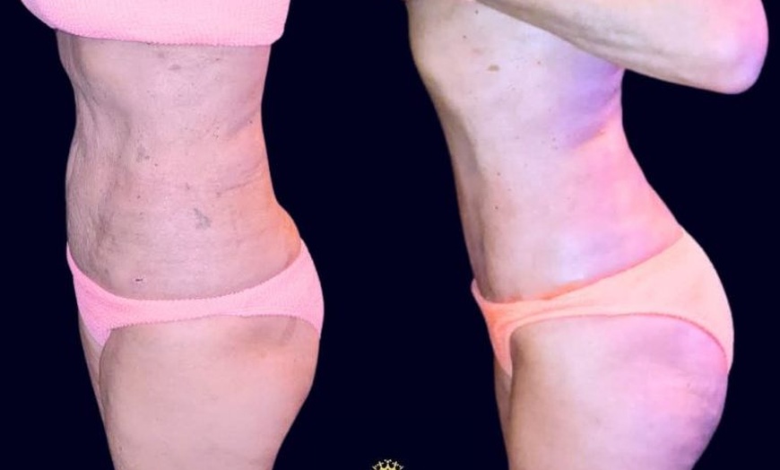 Image 6: Cosmetic Surgery Aftercare 1 2 Or 3 Packs of 30-Min Recovery Treatment