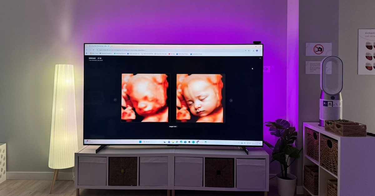 Ecografía emocional prenatal 5D o 8K en Madrid