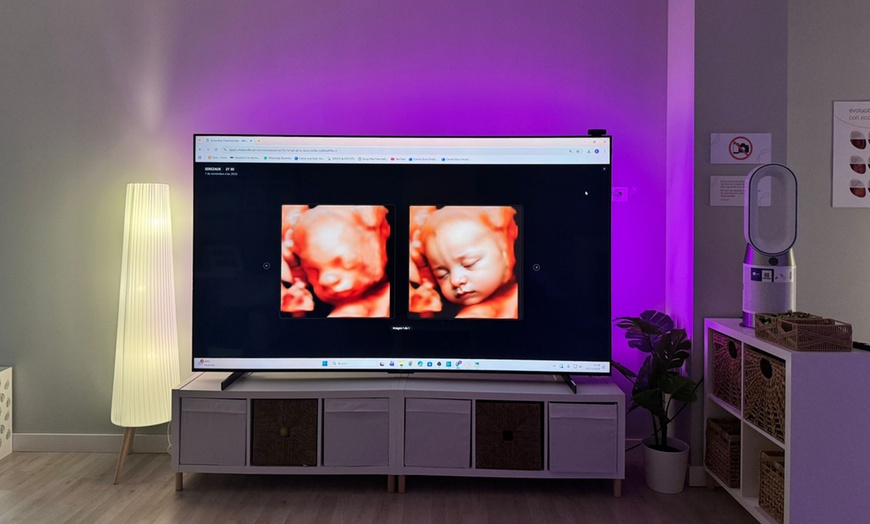 Image 1: ¡Conoce a tu bebé! Ecografía emocional 5D o 8K con vídeo y canastilla