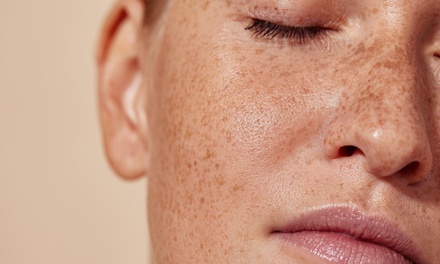 30 Units of Botox - Dermacare