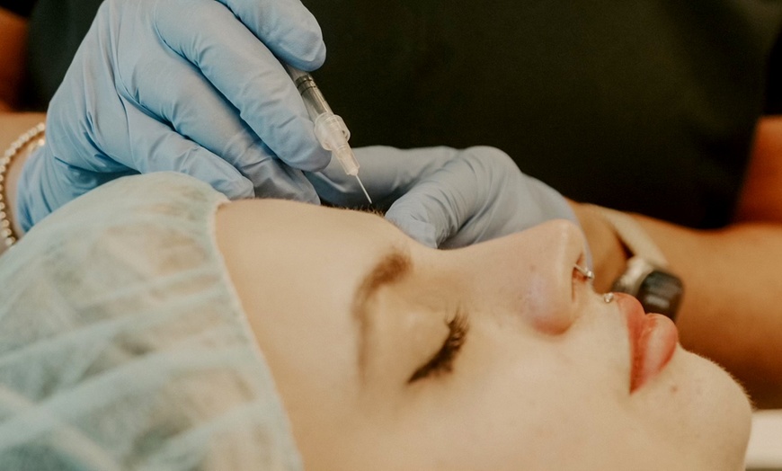 Image 2: 20 Units of Jeuveau, Half syringe of Versa Lip Filler, or Both 