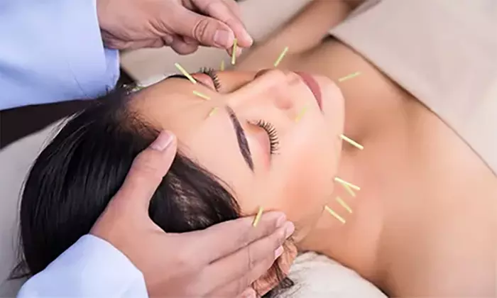 Holistic wellness with Facial or First Acupuncture Session with initial consultation (Up to 50% Off) - Second Medium