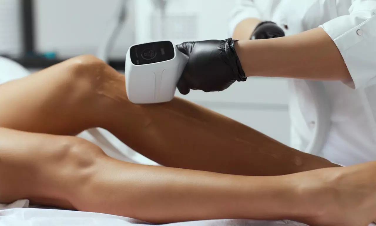 Unlimited Laser Hair Removal Treatments on One Small, Medium, Large, or Xtra Large Area (Up to 95% Off) - Second Medium