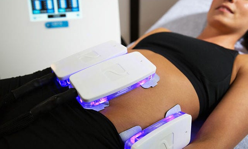 Image 1: Pour une silhouette redessinée : cryolipolyse avec Smart Body