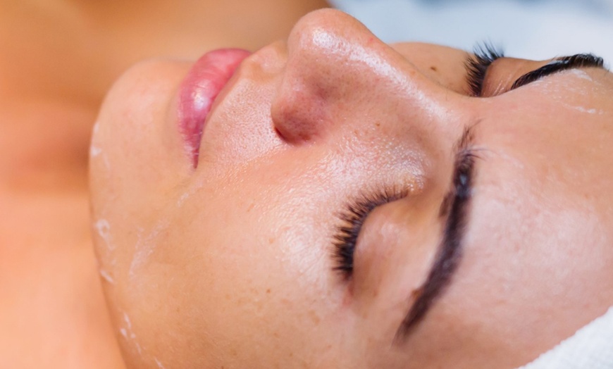 Image 5: Revitalise Your Complexion with Luxury Laser & Skin Facials