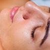Image 5: Revitalise Your Complexion with Luxury Laser & Skin Facials